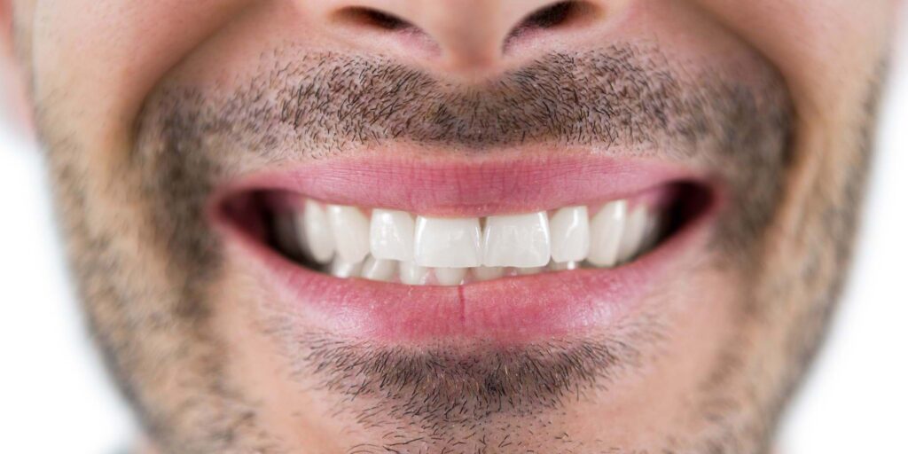 Teeth Whitening