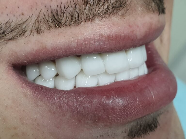 Cosmetic Dentistry